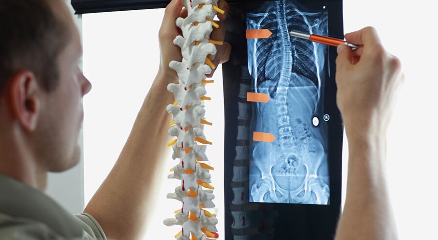 San Antonio spinal cord injury lawyers